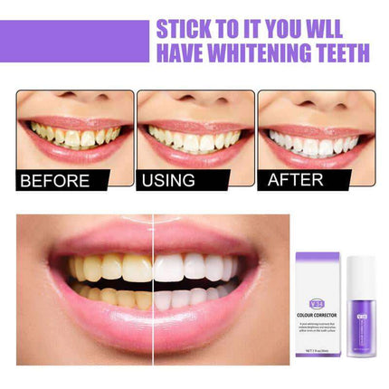 Before and after comparison of 2x Whitening Toothpaste for Deep Stain Removal & Brightening