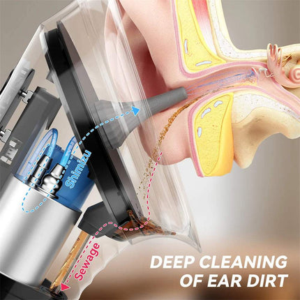 Ear Wax Water Flusher electric ear cleaning irrigation kit showing deep cleaning of ear dirt.