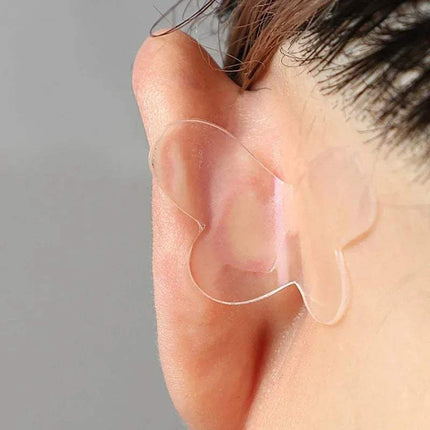 Ear Corrector Stickers applied to an ear for achieving a balanced and natural ear shape.