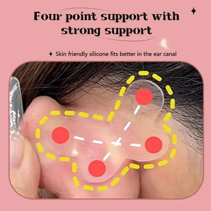 Ear Corrector Stickers provide four point support with skin-friendly silicone for comfortable ear shaping.