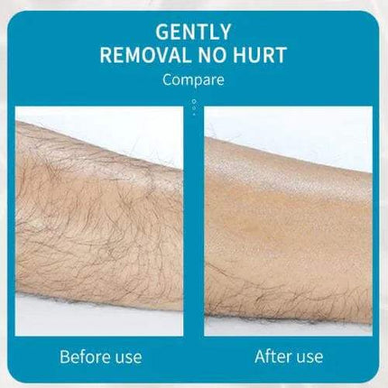 Before and after comparison ofBleame Crystal Hair Eraser for Smooth, Hair-Free Skin
