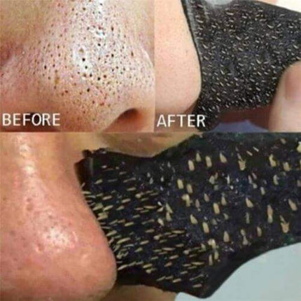 Before and after comparison of a Nose Blackhead Remover Strips for Clear, Smooth Skin