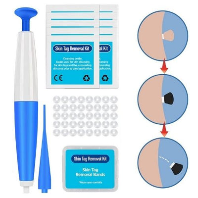 Skin Tag Remover kit including bands and applicator for safe and natural tag removal at home.