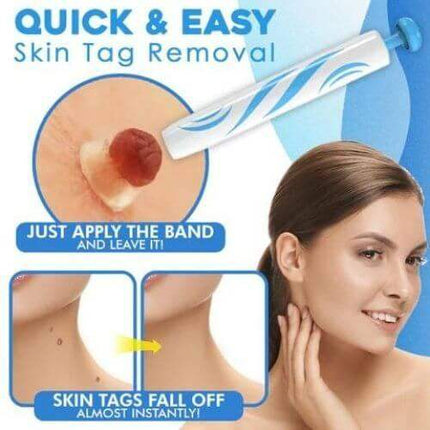 Skin Tag Remover for quick and easy skin tag removal shown on a model's skin and the product.